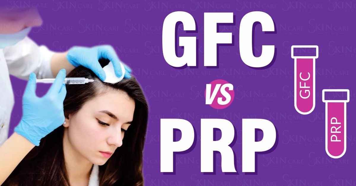 GFC vs PRP